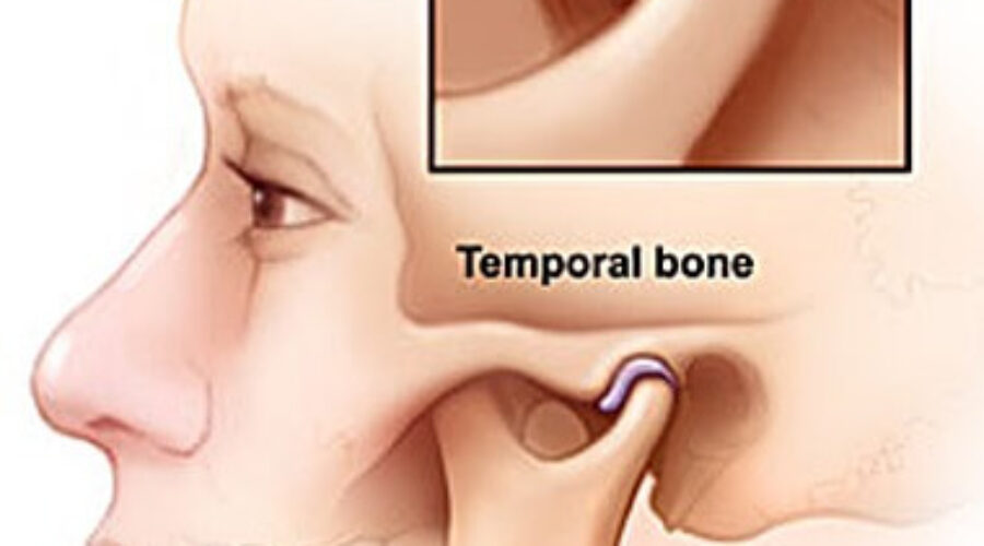 Dental Approaches to Jaw Pain